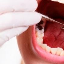 Как быстро и эффективно отбелить зубы в домашних условиях?