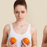 How to increase breasts at home for a girl 2 breast augmentation