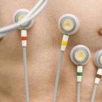 How to properly apply electrodes when recording an ECG?
