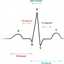 How to decipher a cardiogram of the heart?