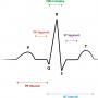 Cum să descifrem o cardiogramă a inimii?